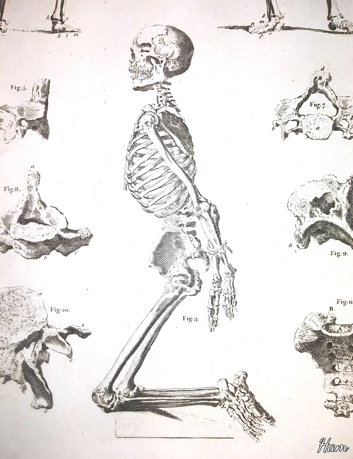 Antique engraving HUMAN SKELETON SKELETAL SYSTEM anatomical art 1790s execution!
