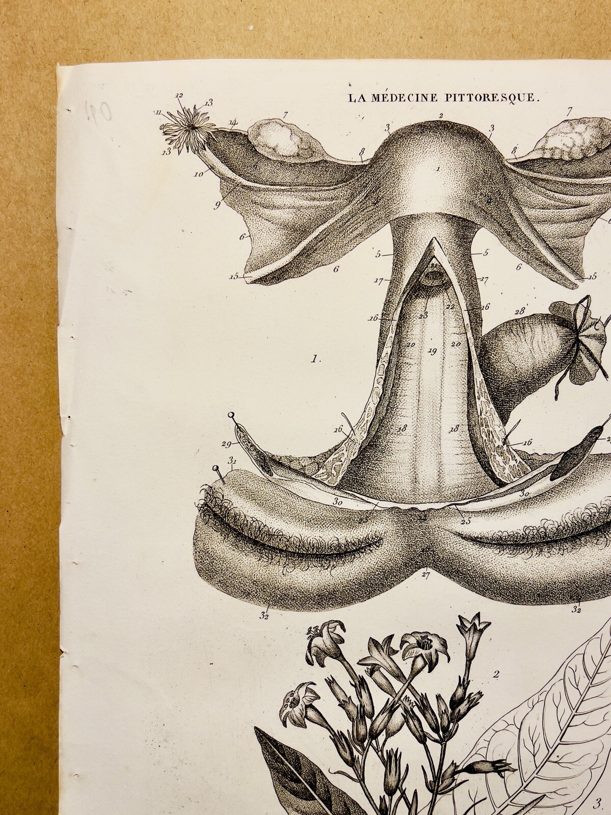 Antique Copper Table 1834 Anatomy Medicine Diseases Doctor Tattoo Sketch