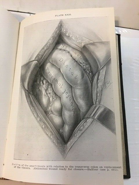 GENERAL SURGERY Ochsner Practical Medicine Series of 1918 Volume II Antique Book