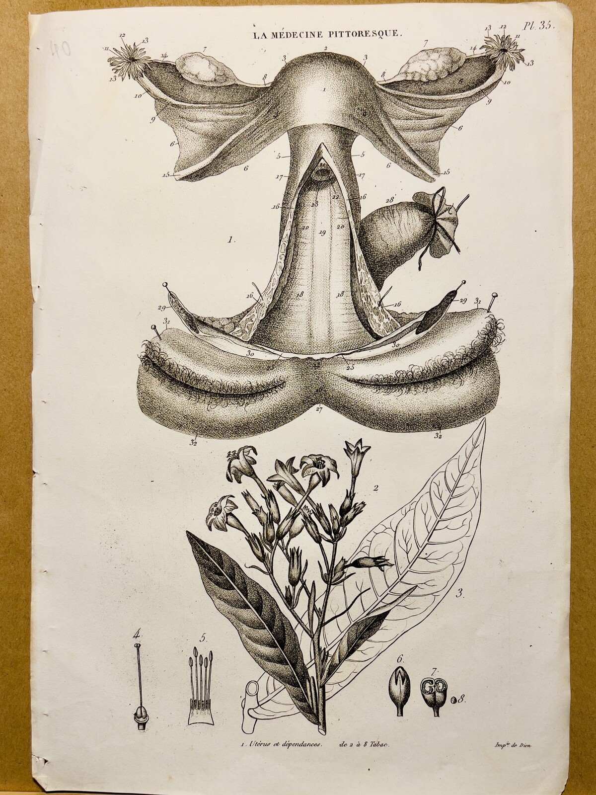 Antique Copper Table 1834 Anatomy Medicine Diseases Doctor Tattoo Sketch