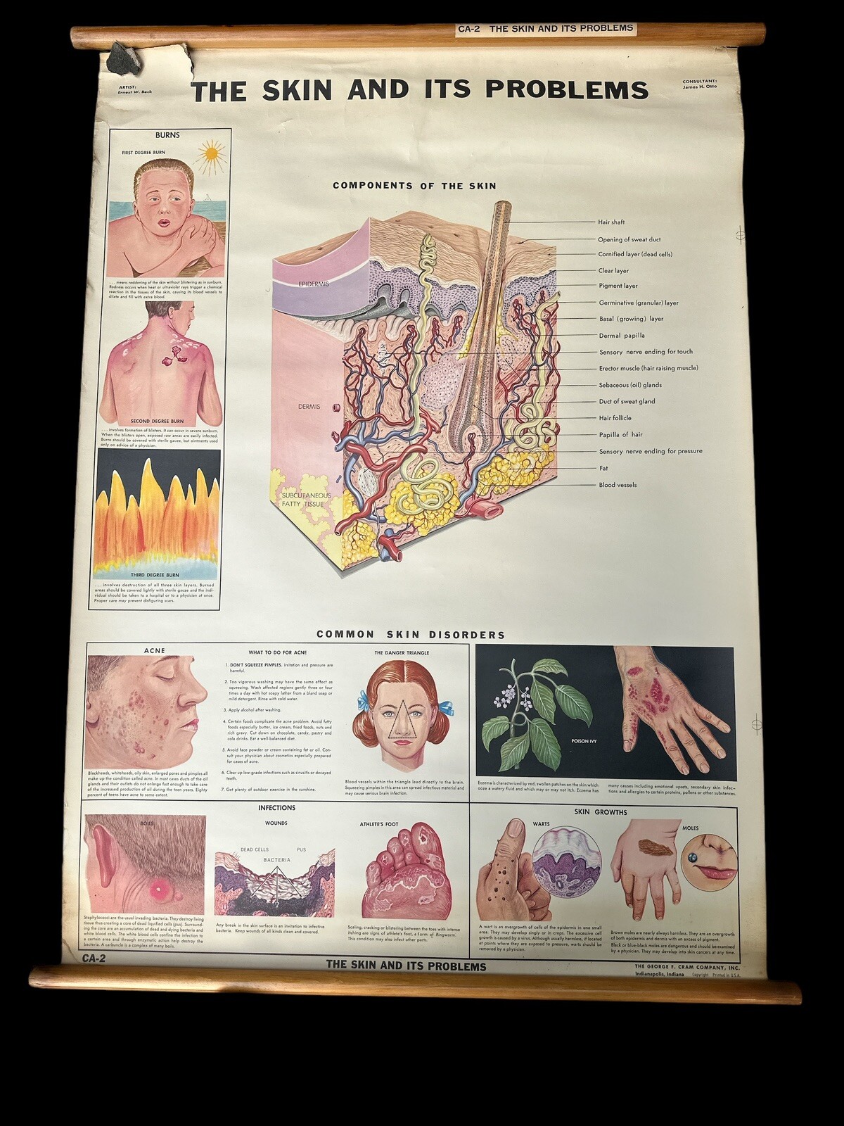 Vintage 1930s George Cram The Skin And Its Problems Classroom Poster Chart CA-2